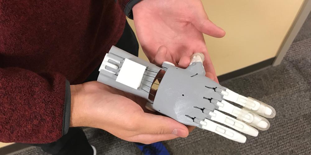 Medical students create prosthetic hand with 3-D printer, Upstate News
